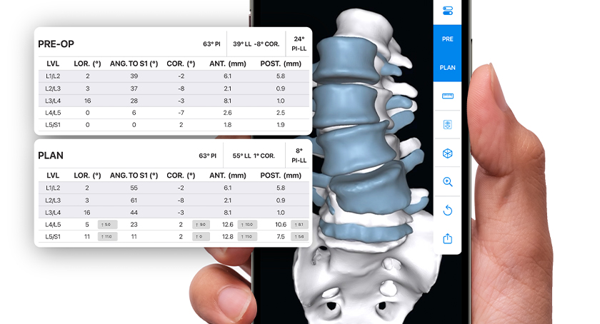 Back in Action: Discussing the Spine Technology Market